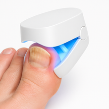 Afbeelding in Gallery-weergave laden, DermaNail - Gepatenteerde nagelschimmeltherapie – voor gezonde nagels binnen 4 weken